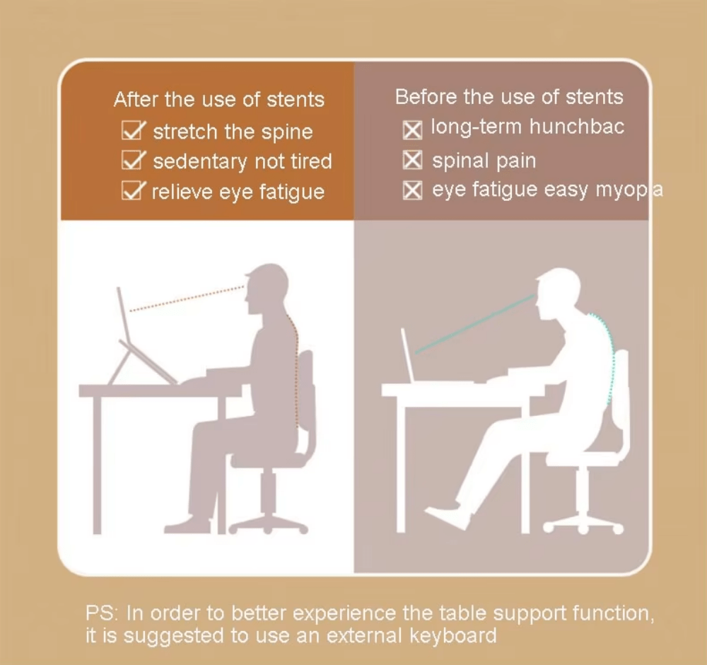 iDock Ergonomic Portable Foldable Computer Mount Holder with 6 Levels Height Adjustment Laptop Stand Riser - iDock Laptopstand